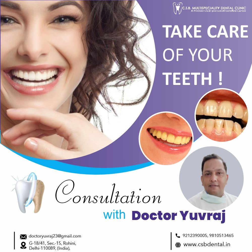 Dental Treatment in rohini sector 15